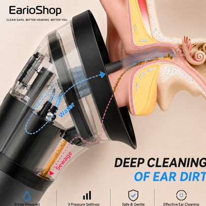 EarioWave™ Electric Ear Wax Irrigation System